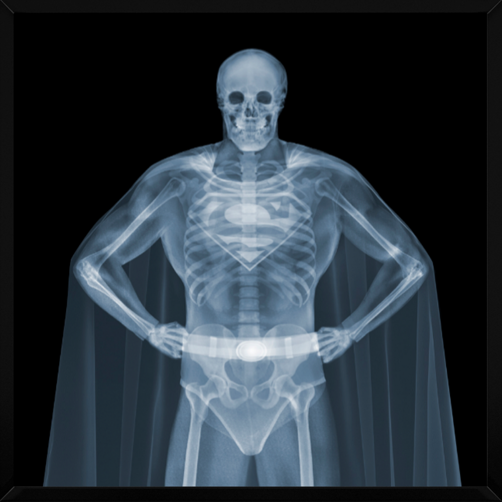 Superman (Framed)