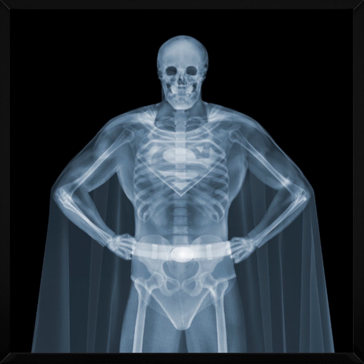 Superman (Framed)