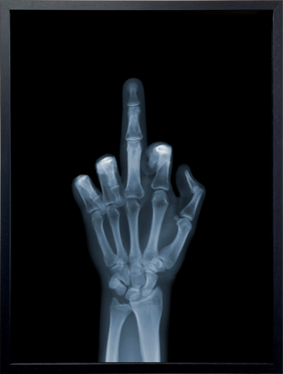 The Finger (Framed)